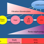 Concept IRA – AKI